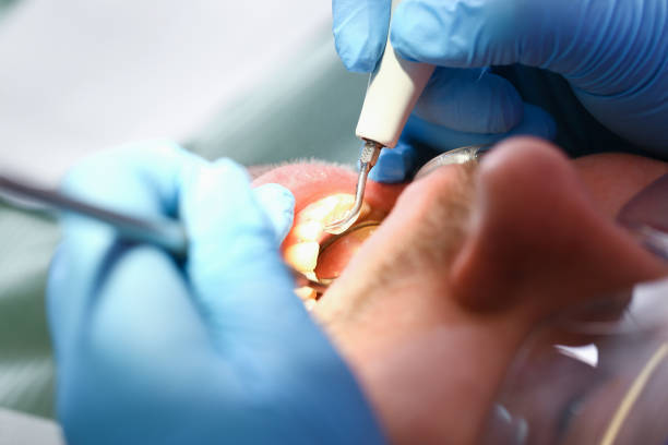 Best Walk-In Emergency Dental Services in Clintwood, VA