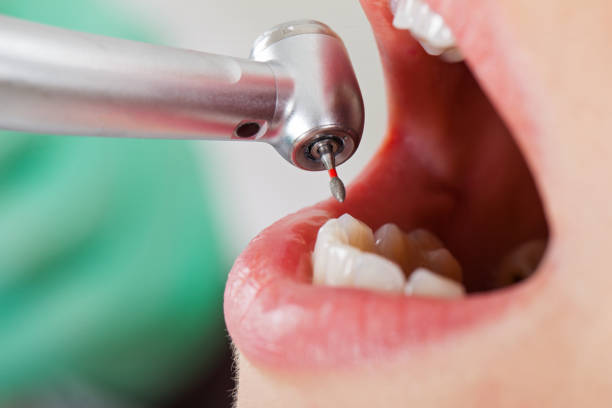Best Emergency Cosmetic Dentistry (e.g., broken veneers) in Clintwood, VA